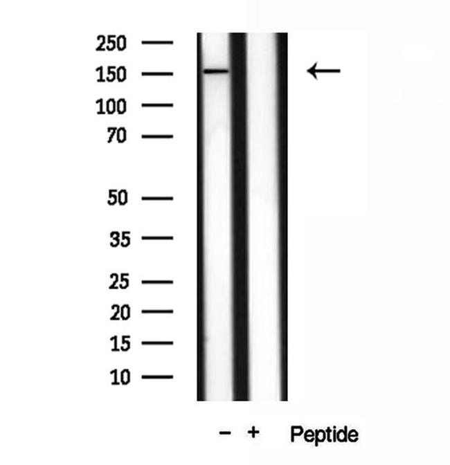 VPRBP Antibody in Western Blot (WB)