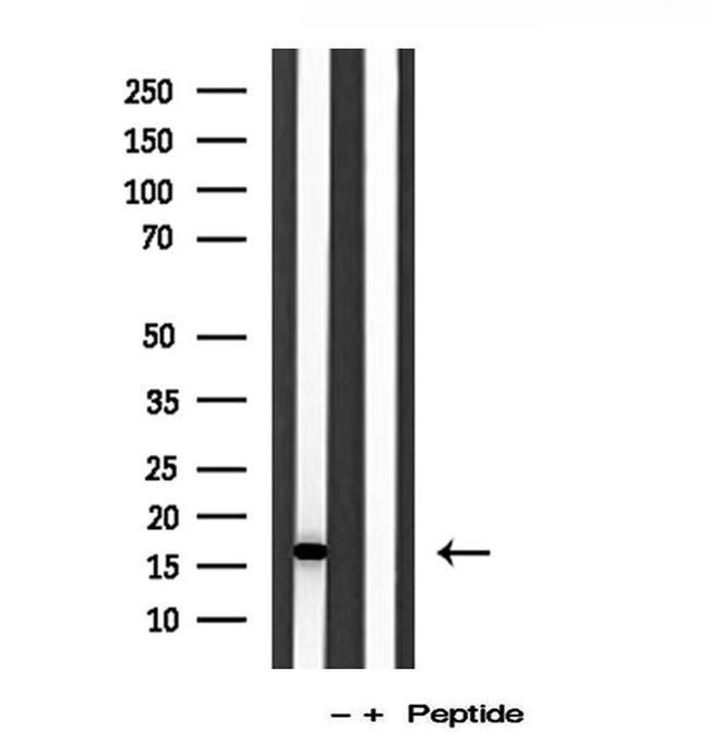 IFT20 Antibody in Western Blot (WB)