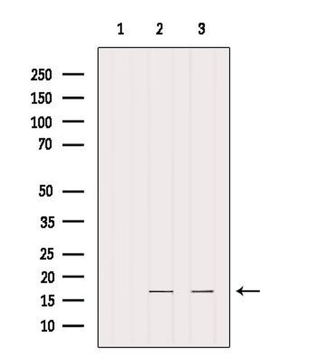 IFT20 Antibody in Western Blot (WB)