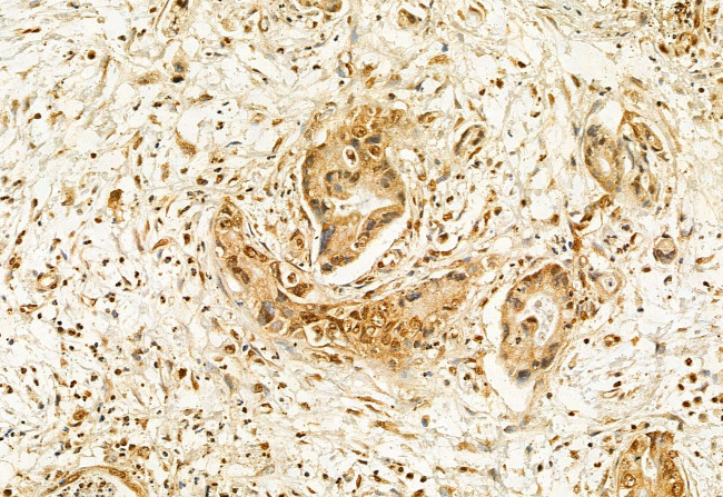 ADAM12 Antibody in Immunohistochemistry (Paraffin) (IHC (P))