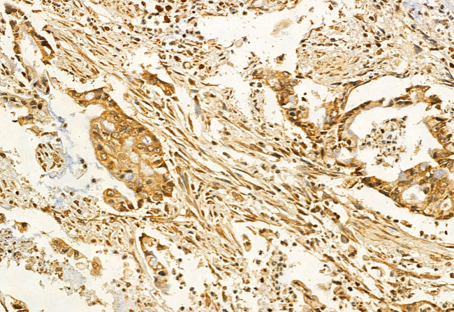 ADAM12 Antibody in Immunohistochemistry (Paraffin) (IHC (P))