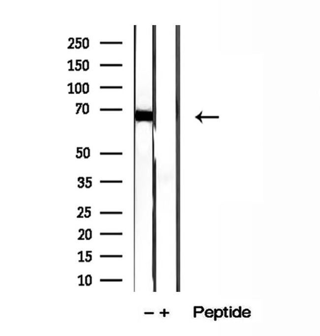 ADAM12 Antibody in Western Blot (WB)