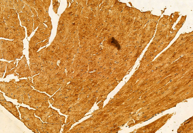 SMCR7L Antibody in Immunohistochemistry (Paraffin) (IHC (P))