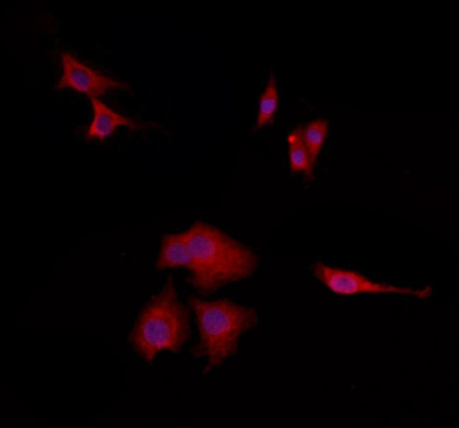 TPI1 Antibody in Immunocytochemistry (ICC/IF)