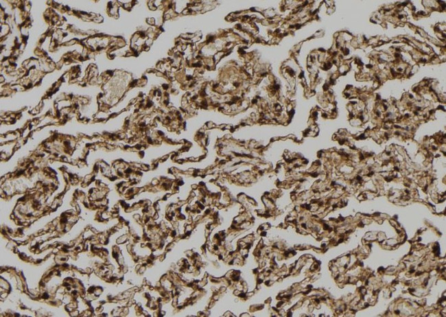 TPI1 Antibody in Immunohistochemistry (Paraffin) (IHC (P))