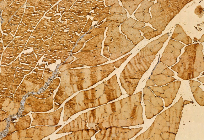 TPI1 Antibody in Immunohistochemistry (Paraffin) (IHC (P))