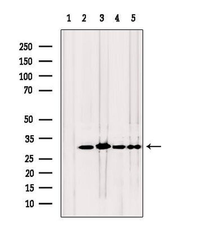 TPI1 Antibody in Western Blot (WB)