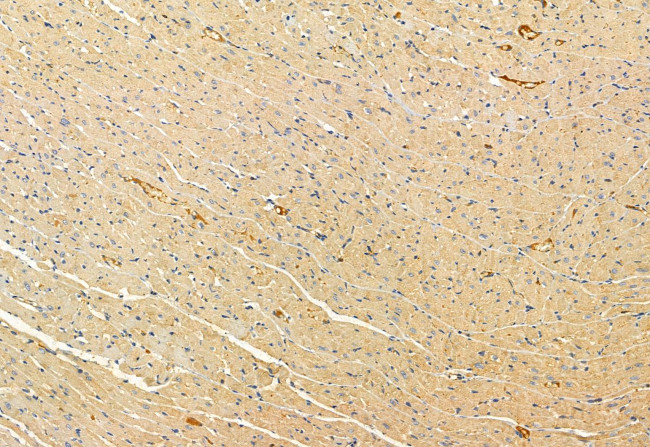 YME1L1 Antibody in Immunohistochemistry (Paraffin) (IHC (P))