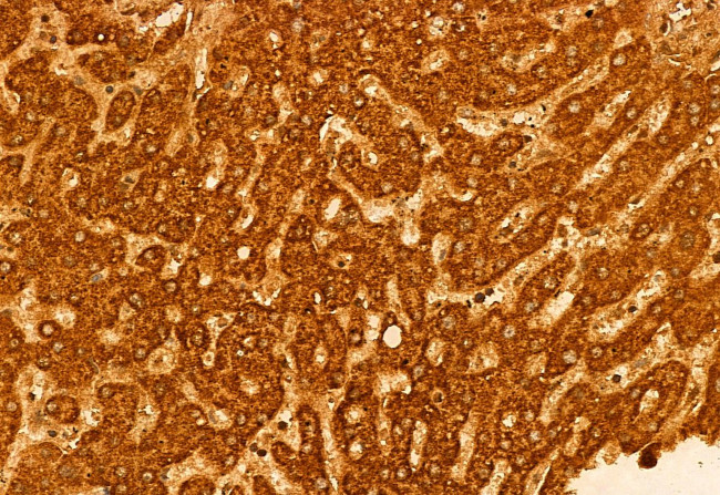 ECHS1 Antibody in Immunohistochemistry (Paraffin) (IHC (P))