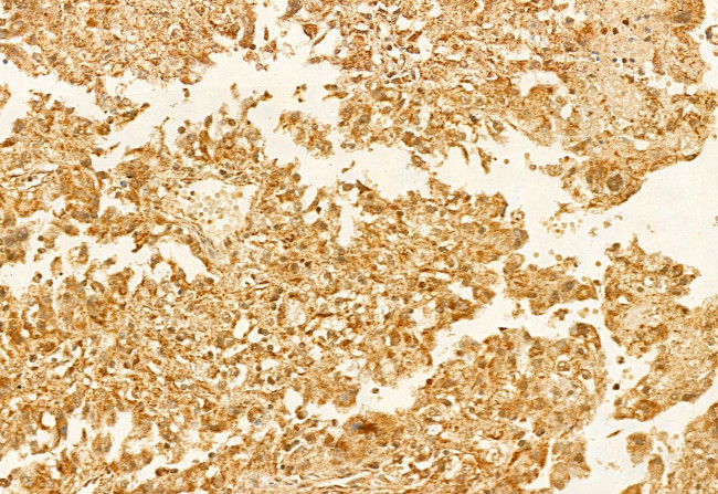 ECHS1 Antibody in Immunohistochemistry (Paraffin) (IHC (P))