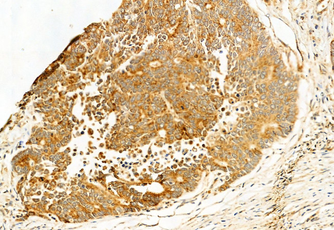 MKS1 Antibody in Immunohistochemistry (Paraffin) (IHC (P))