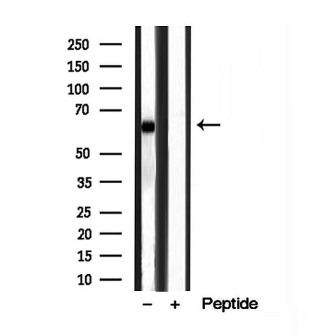 MKS1 Antibody in Western Blot (WB)