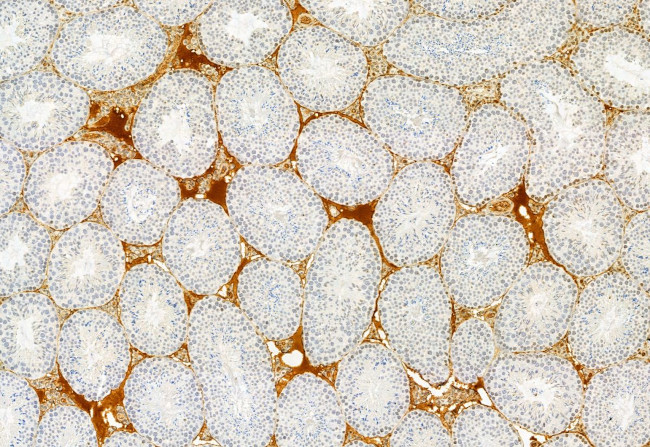 TCTN1 Antibody in Immunohistochemistry (Paraffin) (IHC (P))