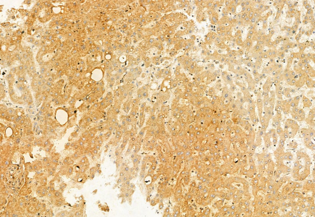 TCTN1 Antibody in Immunohistochemistry (Paraffin) (IHC (P))