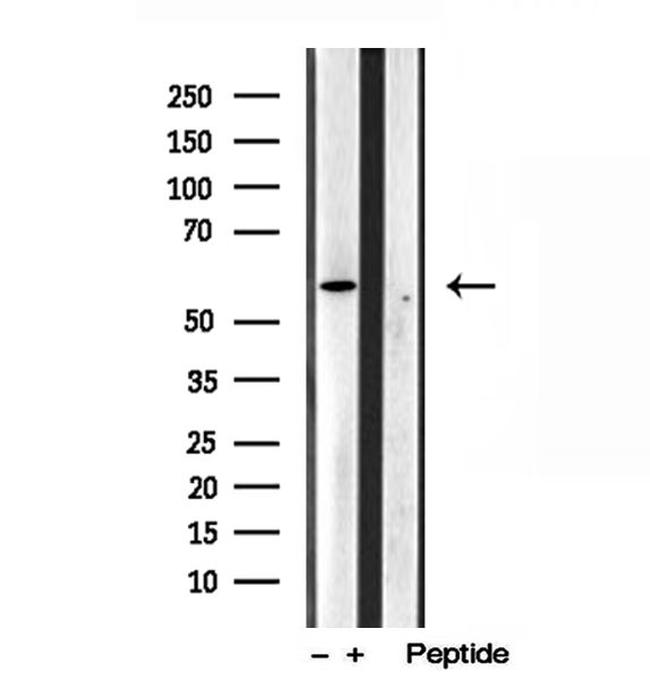 TCTN1 Antibody in Western Blot (WB)