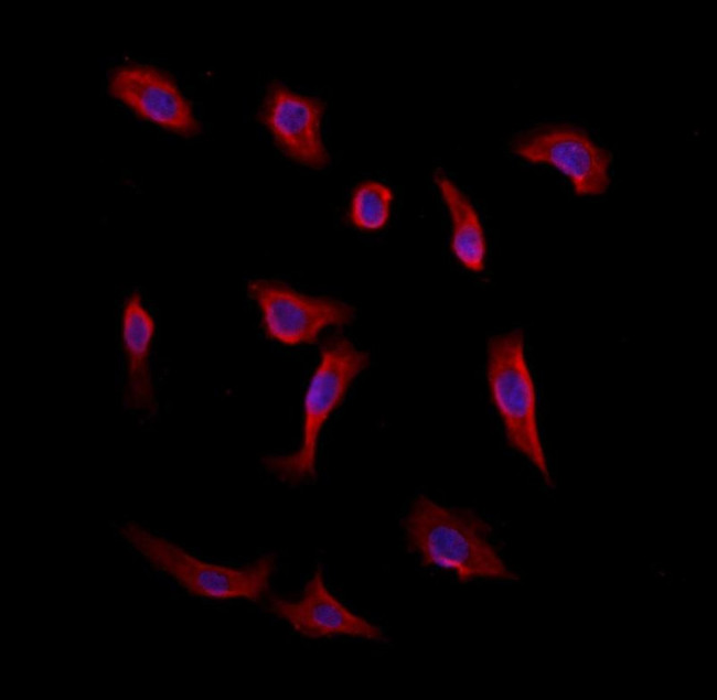 CAMSAP2 Antibody in Immunocytochemistry (ICC/IF)