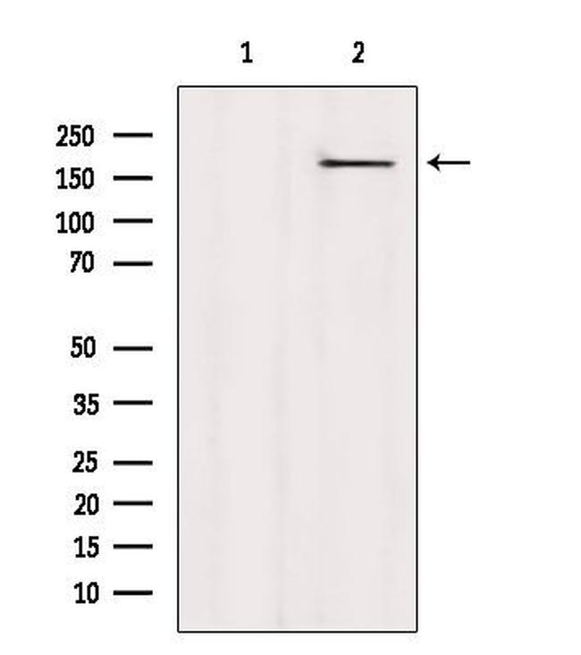 CAMSAP2 Antibody in Western Blot (WB)