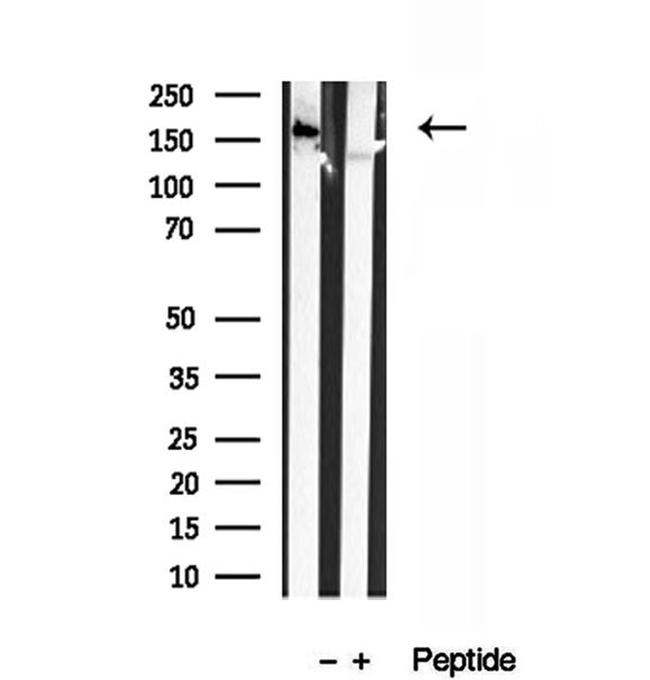 CAMSAP2 Antibody in Western Blot (WB)