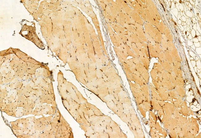 PRKCDBP Antibody in Immunohistochemistry (Paraffin) (IHC (P))