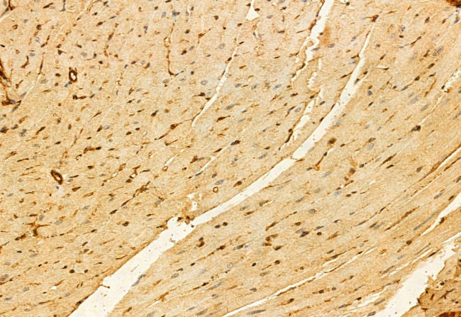 PRKCDBP Antibody in Immunohistochemistry (Paraffin) (IHC (P))