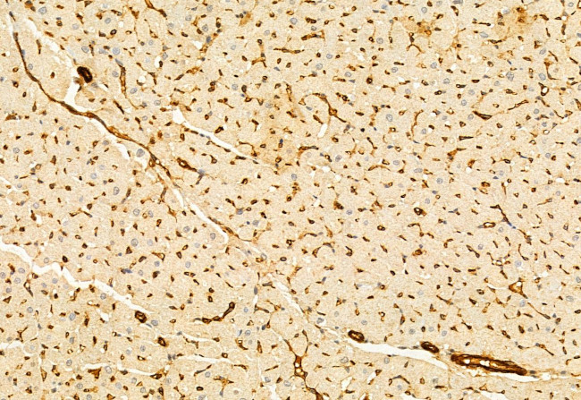 PRKCDBP Antibody in Immunohistochemistry (Paraffin) (IHC (P))