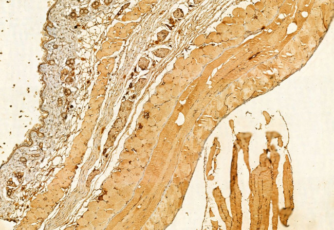 PRKCDBP Antibody in Immunohistochemistry (Paraffin) (IHC (P))