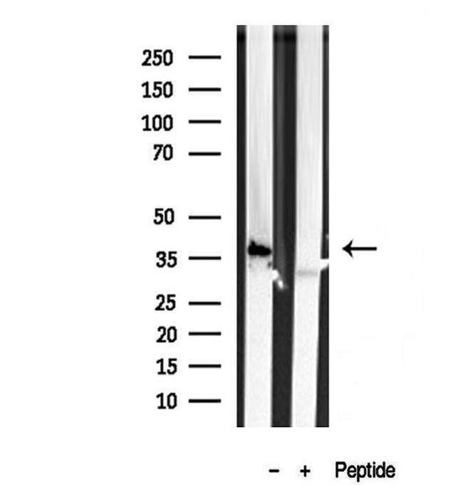 PRKCDBP Antibody in Western Blot (WB)