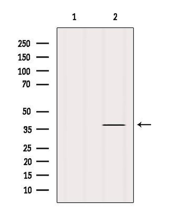 PRKCDBP Antibody in Western Blot (WB)