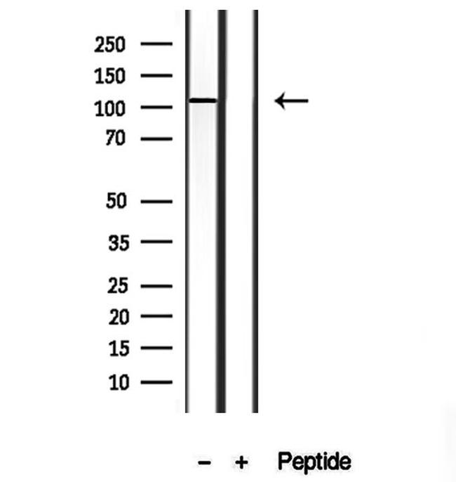 TMEM67 Antibody in Western Blot (WB)