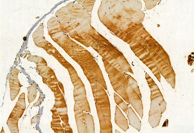 Pallidin Antibody in Immunohistochemistry (Paraffin) (IHC (P))