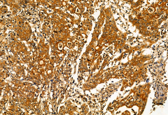 Pallidin Antibody in Immunohistochemistry (Paraffin) (IHC (P))