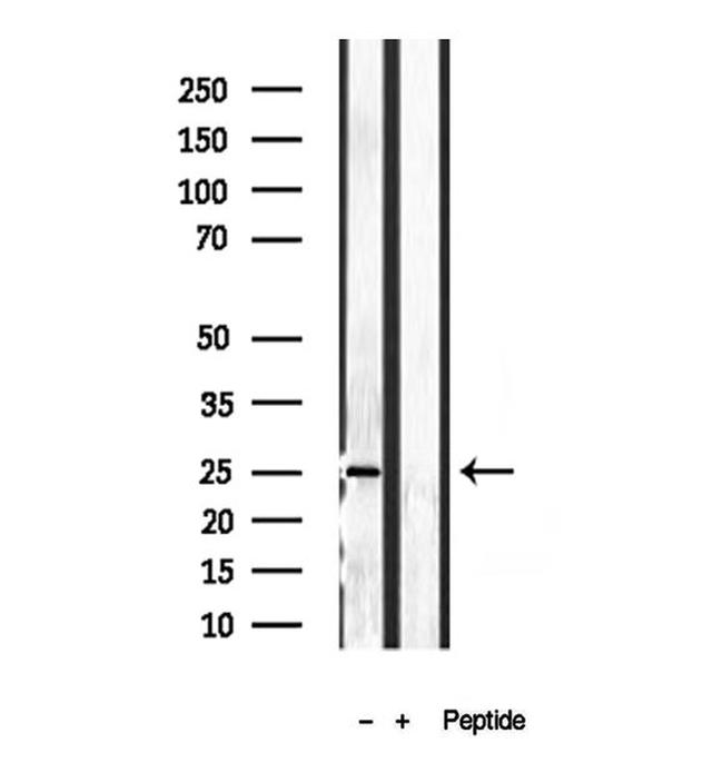 Pallidin Antibody in Western Blot (WB)