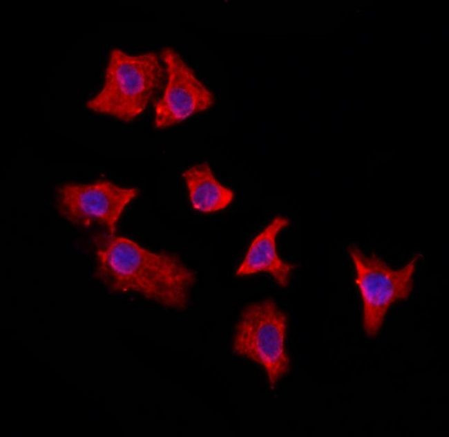 EXOC2 Antibody in Immunocytochemistry (ICC/IF)