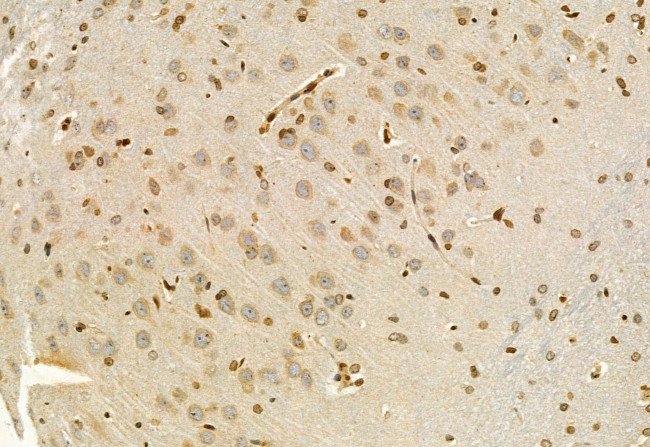 EXOC2 Antibody in Immunohistochemistry (Paraffin) (IHC (P))