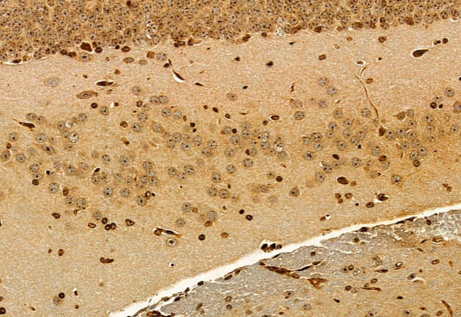 EXOC2 Antibody in Immunohistochemistry (Paraffin) (IHC (P))