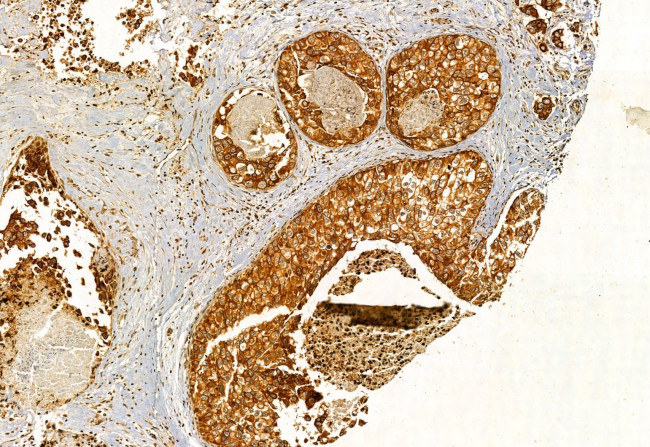 EXOC2 Antibody in Immunohistochemistry (Paraffin) (IHC (P))