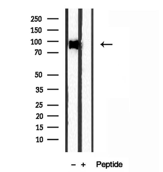 EXOC2 Antibody in Western Blot (WB)