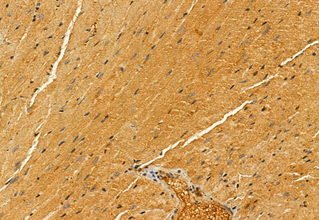 PYCR1 Antibody in Immunohistochemistry (Paraffin) (IHC (P))