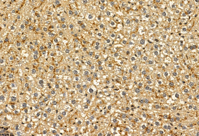 PYCR1 Antibody in Immunohistochemistry (Paraffin) (IHC (P))