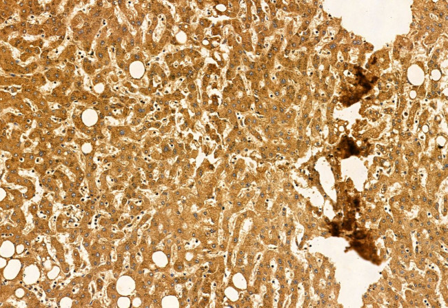 PYCR1 Antibody in Immunohistochemistry (Paraffin) (IHC (P))