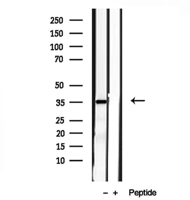 PYCR1 Antibody in Western Blot (WB)