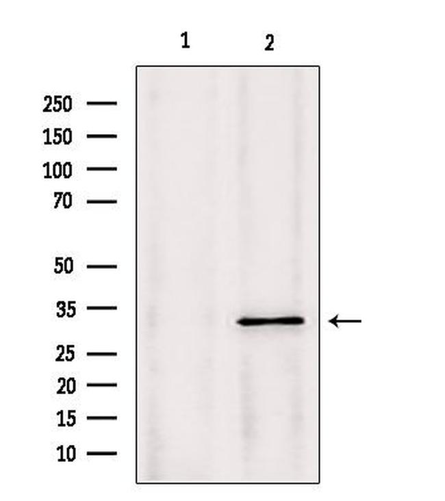 PYCR1 Antibody in Western Blot (WB)