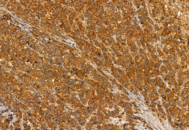 TAGLN2 Antibody in Immunohistochemistry (Paraffin) (IHC (P))