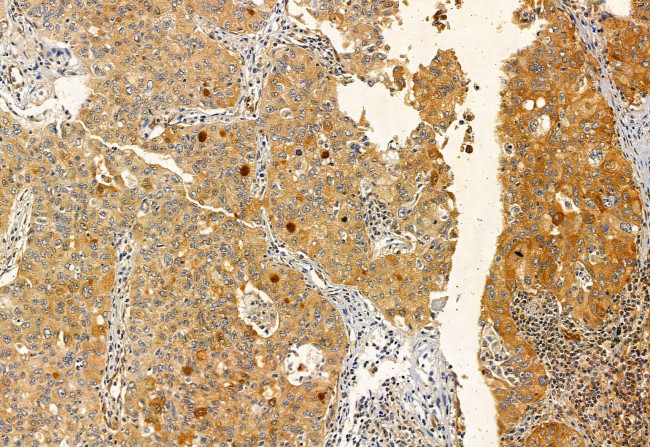 TAGLN2 Antibody in Immunohistochemistry (Paraffin) (IHC (P))