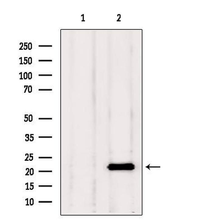 TAGLN2 Antibody in Western Blot (WB)