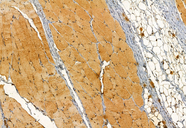 GALC Antibody in Immunohistochemistry (Paraffin) (IHC (P))