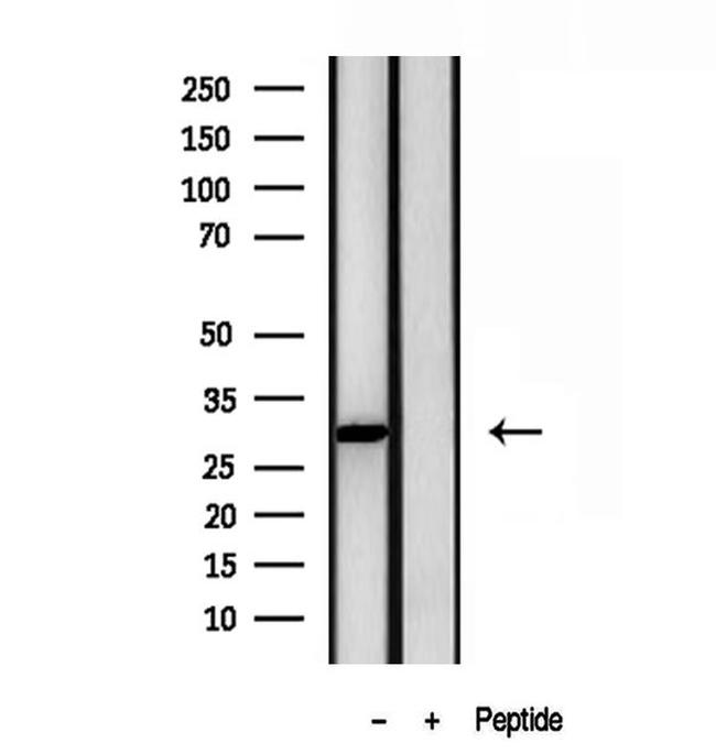 GALC Antibody in Western Blot (WB)