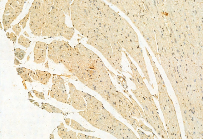 LMOD3 Antibody in Immunohistochemistry (Paraffin) (IHC (P))