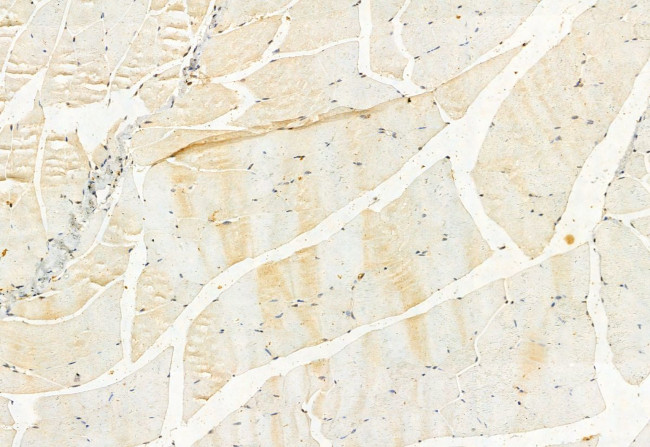 LMOD3 Antibody in Immunohistochemistry (Paraffin) (IHC (P))