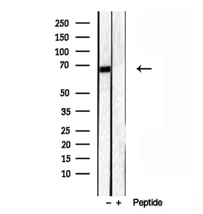 LMOD3 Antibody in Western Blot (WB)